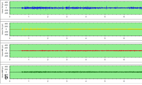 A screenshot of a graph

Description automatically generated